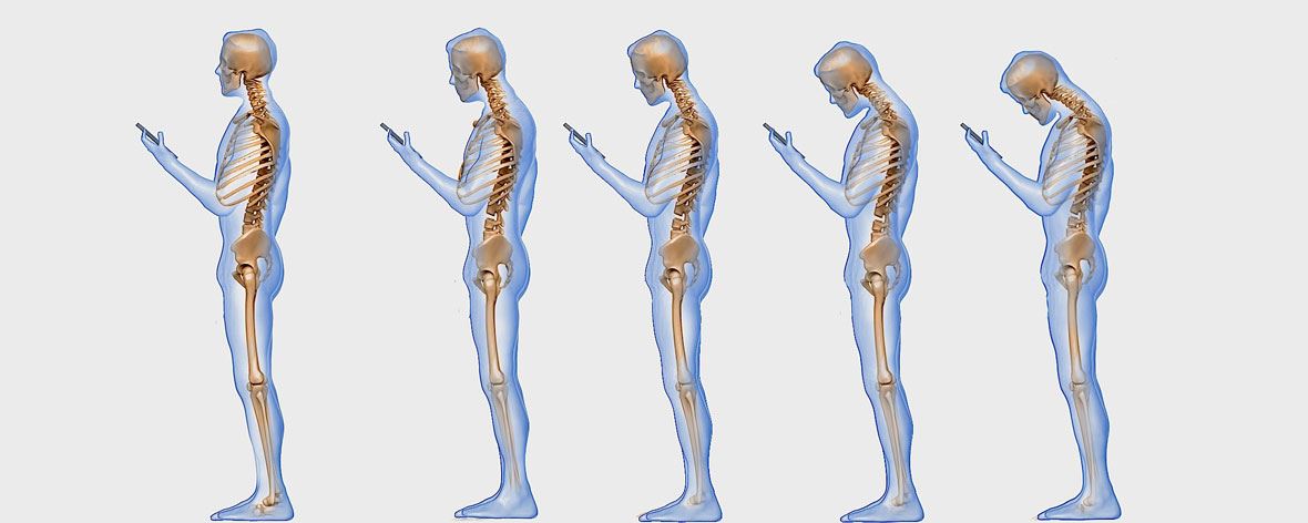 wpływ smartfona na kręgosłup